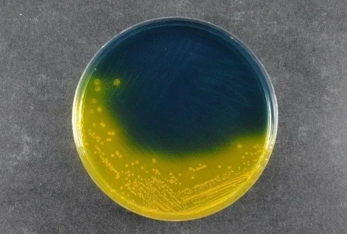 Εξασφάλιση της ασφάλειας των τροφίμων: Το Salmonella Shigella Agar (SS) του Babio υποστηρίζει τα πρότυπα ανίχνευσης παγκόσμιων παθογόνων
