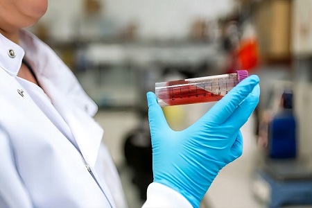 Διατηρήστε δείγματα αναπνευστικών στοιχείων με μέσο μεταφοράς του Babio