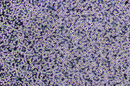 Agar Dextrose Potato (USP) - Αξιόπιστο μέσο για ανίχνευση μούχλας και ζύμης