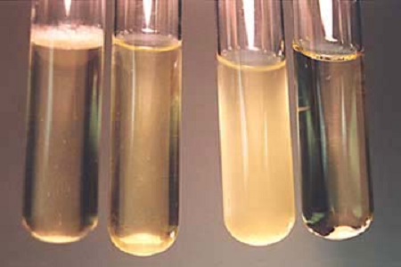 Η Babio λανσάρει ζωμό έγχυσης εγκεφάλου υψηλής απόδοσης για τα παγκόσμια εργαστήρια μικροβιολογίας