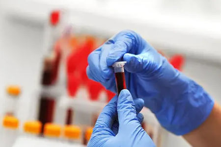 Η BABIO λανσάρει το γρήγορο τεστ εγκυμοσύνης βοοειδών φθορισμού