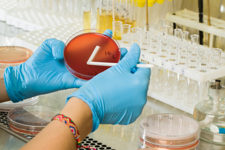 BABIO's MacConkey Agar Medium – Premium Selective Isolation for Global Microbiological Diagnostics